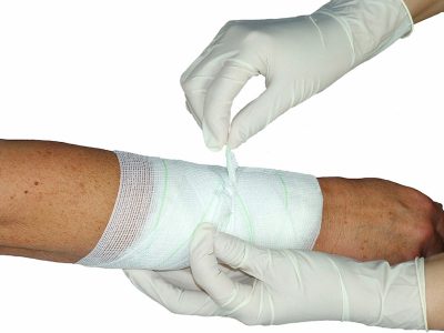 Bandaging arm